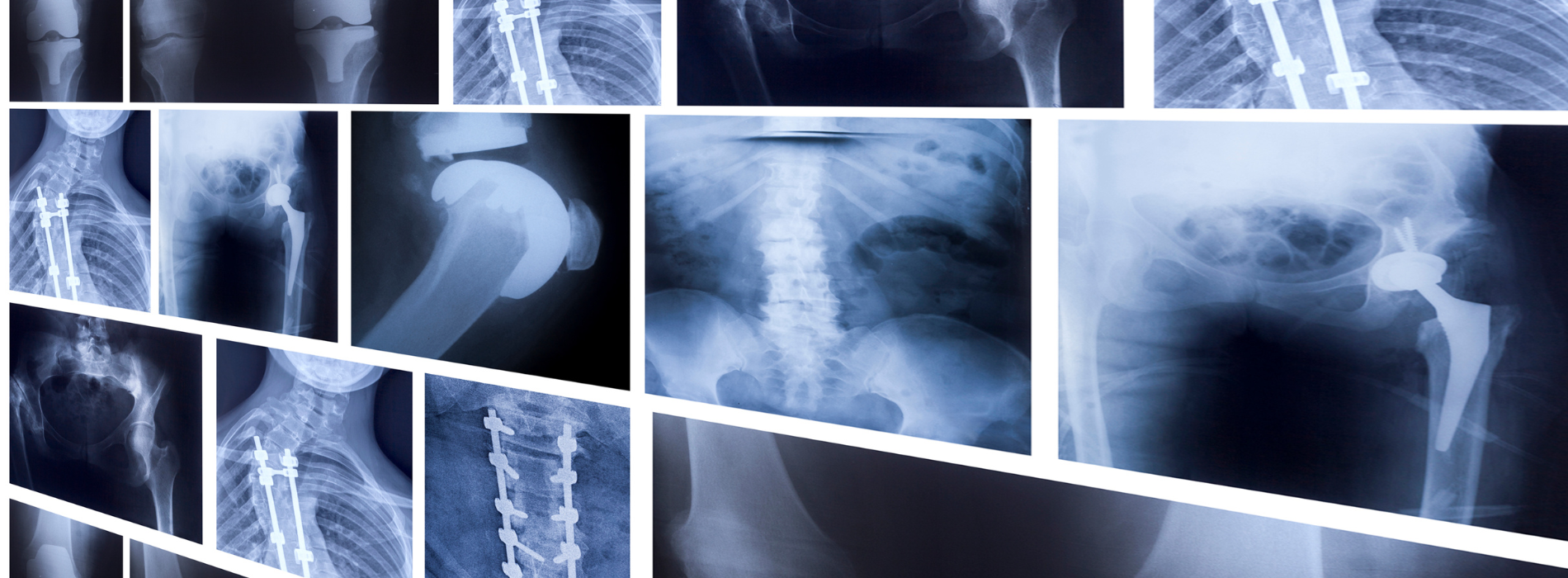 Center for Xray Optics University at Albany